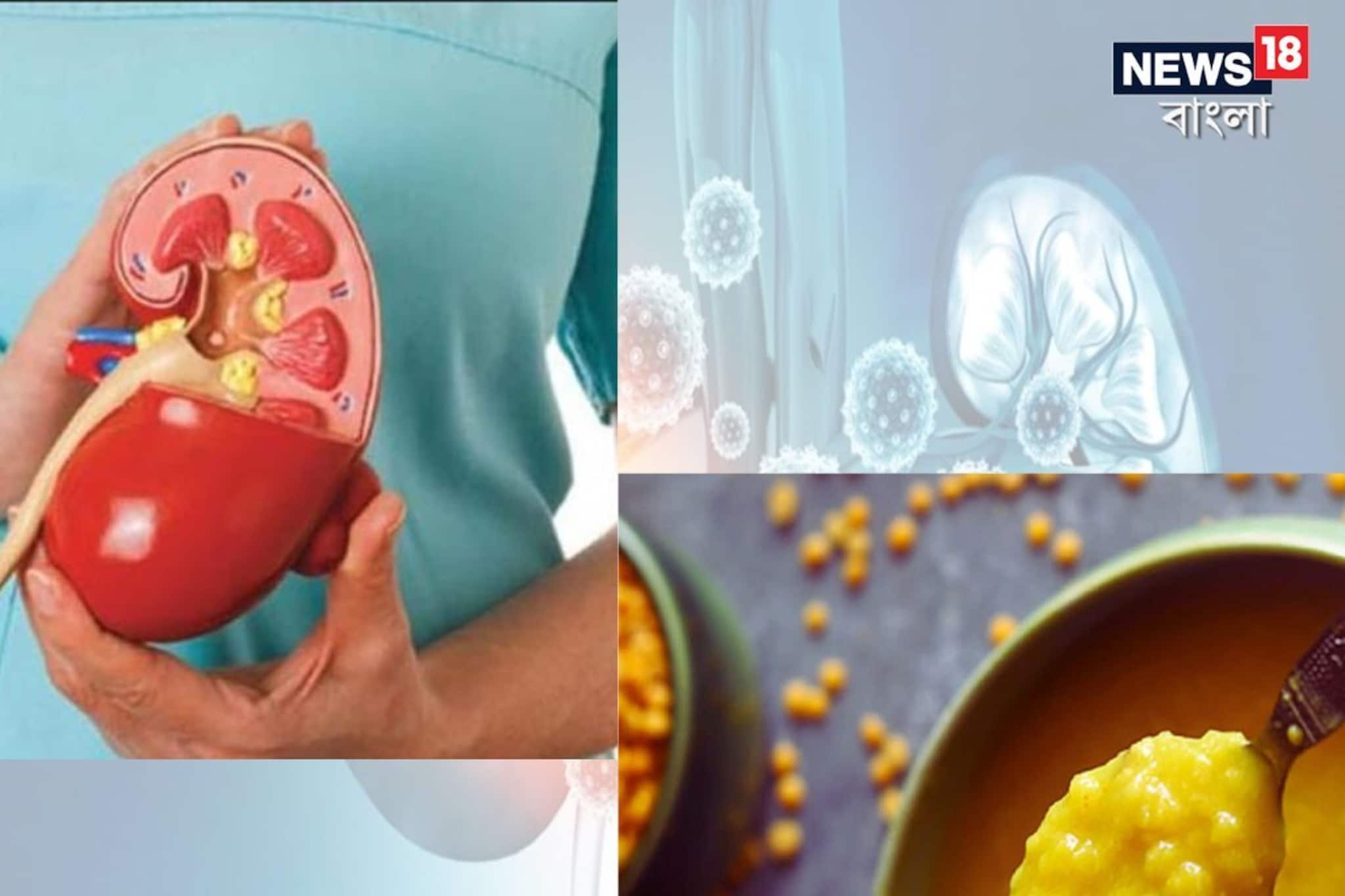 'কিডনি' রোগমুক্ত রাখতে কম 'পটাশিয়াম' খেতে হবে, 'কিডনি' সুস্থ রাখতে কোন ডাল খাবেন?