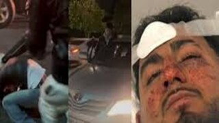 অস্ট্রেলিয়ায় ফের ভারতীয় ছাত্রের উপর আক্রমণ। অস্ট্রেলিয়ায় ফের ভারতীয় ছাত্রের উপর আক্রমণ।