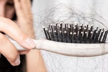 Hairfall and Baldness: গোছাগোছা চুল পড়ে মাথায় টাক? শুধু জিনগত কারণ বা চুলের অযত্ন নয়, জেনে নিন, কোন কোন অসুখের ইঙ্গিত দেয় টাক পড়া