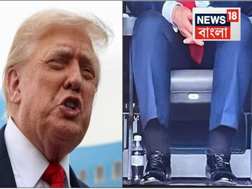 পা ফুলে টইটম্বুর..শিরার এই জটিল রোগের সঙ্গে লড়ছেন ট্রাম্প! কতটা ভয়ঙ্কর? উপসর্গই বা কী?