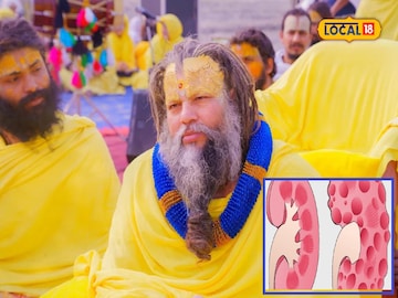 ADPKD- তে আক্রান্ত প্রেমানন্দ মহারাজ,এই মারণ রোগে ঠিক কীভাবে ক্ষতিগ্রস্ত হয় কিডনি,কেন হয় ADPKD- তে আক্রান্ত প্রেমানন্দ মহারাজ,এই মারণ রোগে ঠিক কীভাবে ক্ষতিগ্রস্ত হয় কিডনি,কেন হয়