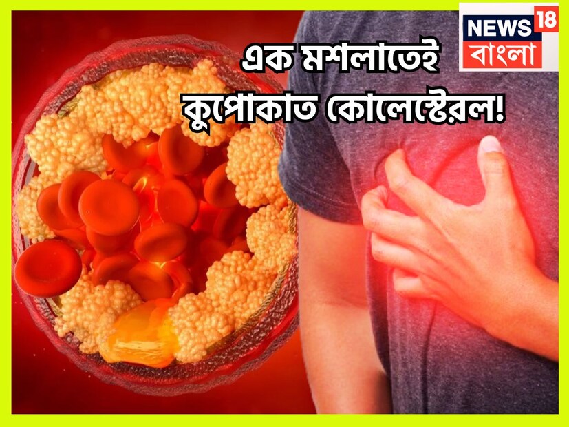 শরীরে দুই ধরনের কোলেস্টেরল থাকে, খারাপ ও ভাল কোলেস্টেরল থাকে ৷ প্রতীকী ছবি ৷