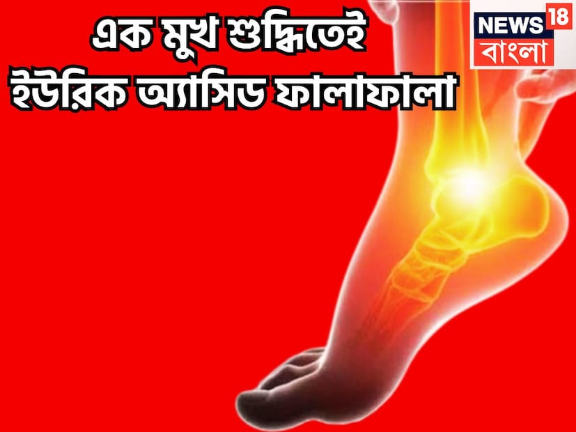 শরীরে ইউরিক অ্যাসিডের নানান রকমের সমস্যা শরীরকে ঘিরে ধরে ৷ খারাপ খাবার দাবার, লাইফস্টাইল, এমন বেশ কিছু ওষুধ আছে ৷ প্রতীকী ছবি ৷