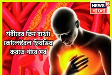 শরীরের তিন স্থানে ভয়ঙ্কর যন্ত্রণা! পরিস্থিতি মারাত্মক হতে পারে! কোলেস্টরলে ছিন্নভিন্ন