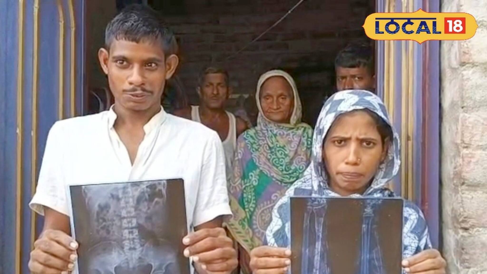 স্বামীর শরীরে গিজগিজ করছে অসংখ্য সূঁচ! কুঁকড়ে যাচ্ছে যন্ত্রণায়, কালাজাদু নাকি মারণ রোগ?