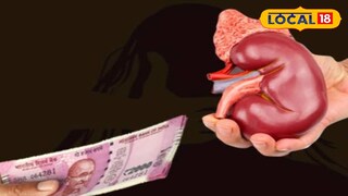 মোটা অঙ্কের অর্থের লোভে কিডনি বিক্রি (Representative Image) মোটা অঙ্কের অর্থের লোভে কিডনি বিক্রি (Representative Image)