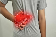 ওজন কম কিন্তু পেট ফুলে যাচ্ছে? সাবধান! 'লিভার সিরোসিস'-এর আগে শরীর আর কোন ৪ ইঙ্গিত দেয়?