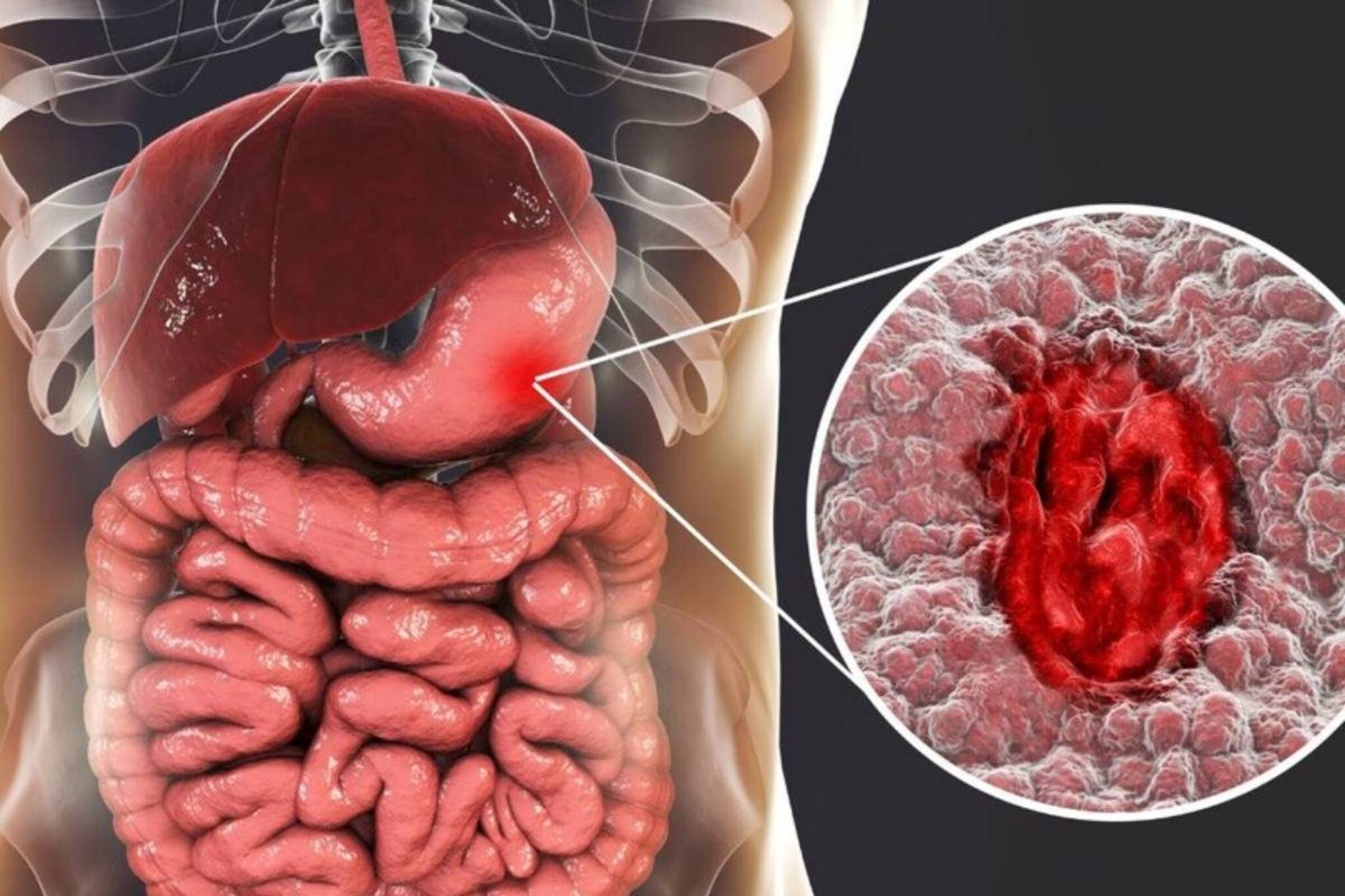 ক্যানসারকেও হারানো সম্ভব! এই ৬ অভ্যাস বদলালেই শরীর ছুঁতে পারবে না ক্যানসার! কীভাবে জানুন