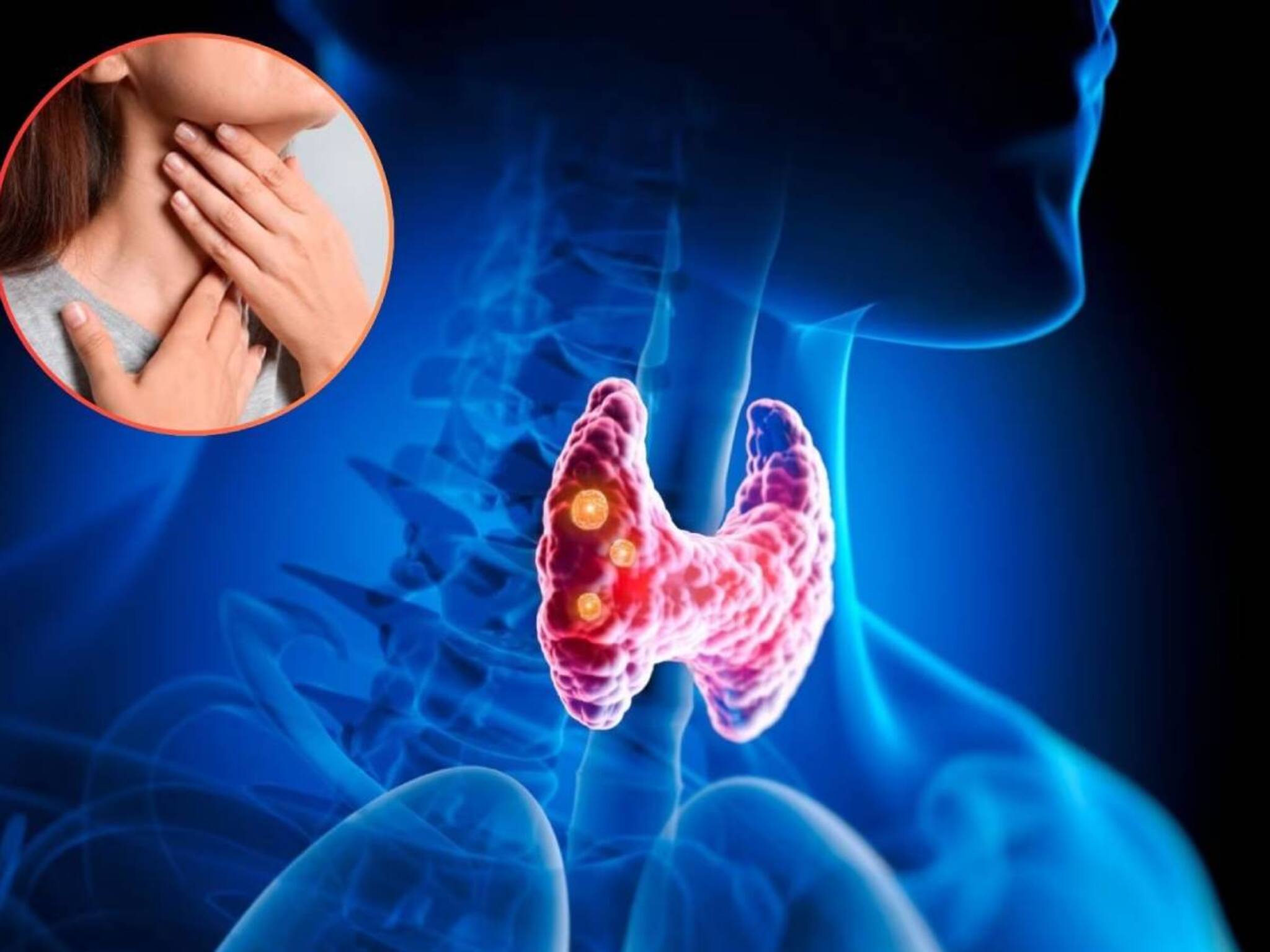 Thyroid Eating Tips: রুটি খেয়ে কমান থাইরয়েড! তবে গমের আটা নয়! চাপাটি বানান ‘এই’ জিনিস দিয়ে! পালাবে রোগ