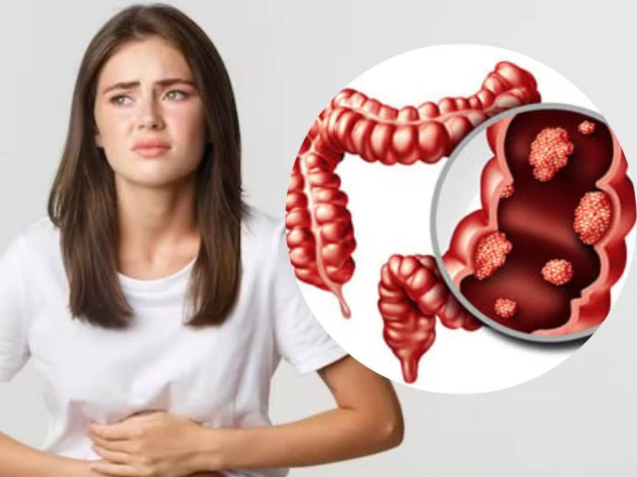Food to stop Colon Cancer: মলদ্বারে ক্যানসার রুখতে ঢাল হয়ে দাঁড়ায় এই ৫ সবজি! মারণরোগকে ঢুকতে দেয় না শরীরে!