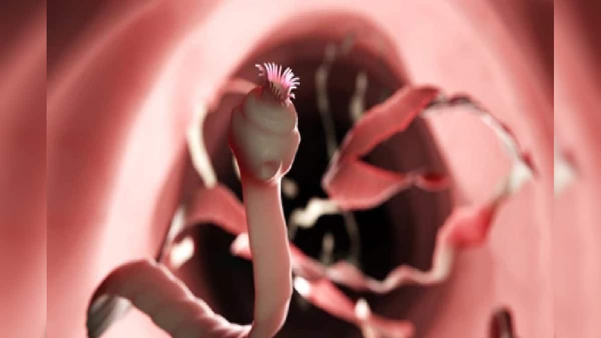 Tapeworms: শীতের ৪ সবজিতে গিজগিজ করে ফিতাকৃমি, শরীরে ঢুকে সোজা চলে যায় ব্রেনে,কুরে কুরে খায় ব্রেনের টিস্যু