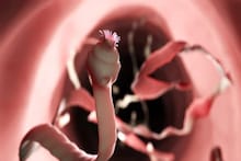 Tapeworms: শীতের ৪ সবজিতে গিজগিজ করে ফিতাকৃমি, শরীরে ঢুকে সোজা চলে যায় ব্রেনে,কুরে কুরে খায় ব্রেনের টিস্যু