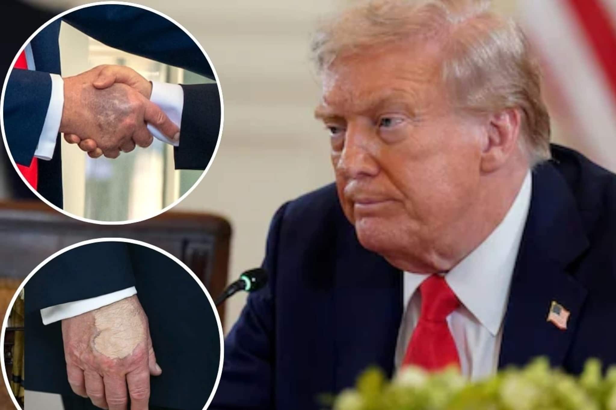 হাতে কালো দাগ, পা ফোলা...কী হয়েছে ট্রাম্পের? ‘ট্রাম্প মৃত’ কেন ভাইরাল সোশ‍্যাল মিডিয়ায়