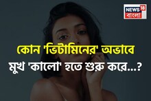 কোন 'ভিটামিনের' অভাবে মুখ 'কালো' হতে শুরু করে জানেন...? সতর্ক হন, নইলে বড় 'বিপদ'!
