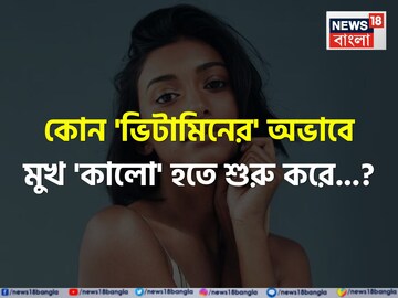 কোন 'ভিটামিনের' অভাবে মুখ 'কালো' হতে শুরু করে জানেন...? সতর্ক হন, নইলে বড় 'বিপদ'!