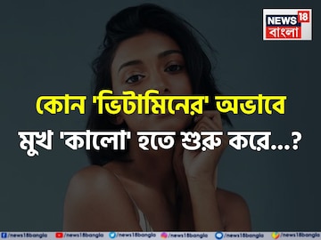 কোন 'ভিটামিনের' অভাবে মুখ 'কালো' হতে শুরু করে জানেন...? সতর্ক হন, নইলে বড় 'বিপদ'! কোন 'ভিটামিনের' অভাবে মুখ 'কালো' হতে শুরু করে জানেন...? সতর্ক হন, নইলে বড় 'বিপদ'!