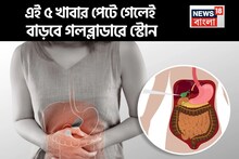 গলব্লাডারে স্টোন হলে এই ৫ খাবার খাবেন না! পেটে বাড়বে পাথর! যন্ত্রণায় দুমড়ে মুচড়ে যাবেন