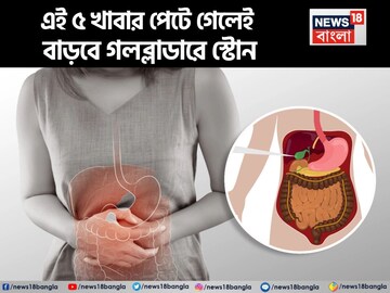 গলব্লাডারে স্টোন হলে এই ৫ খাবার খাবেন না! পেটে বাড়বে পাথর! যন্ত্রণায় দুমড়ে মুচড়ে যাবেন