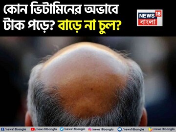 কোন ভিটামিনের অভাবে চুল লম্বা হয় না? কোন ভিটামিনের অভাবে চুল ঝরে টাক পড়ে যায়? জানুন