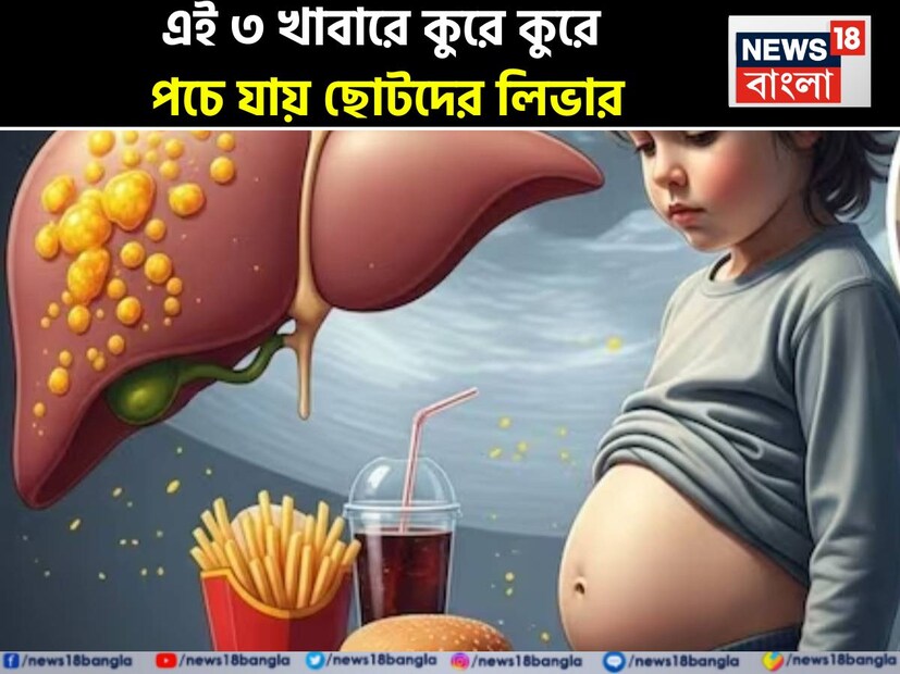 আজকাল অস্বাস্থ্যকর খাদ্যাভ্যাস অনেক গুরুতর রোগের কারণ হয়ে উঠছে। শিশুরা এর কবলে বেশি। এর একটি বড় কারণ হল ফাস্ট ফুডের উন্মাদনা। আসলে, আজকাল শিশুরা ঘরে পুষ্টিকর খাবারের পরিবর্তে বাইরের জাঙ্ক ফুড খেতে পছন্দ করছে। এর ফলে তাদের মধ্যে অনেক গুরুতর রোগের ঝুঁকি বাড়ছে, যার মধ্যে সবচেয়ে উল্লেখযোগ্য হল ফ্যাটি লিভার।