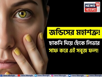 জন্ডিসের মহাশত্রু! ছাকনি দিয়ে ছেঁকে লিভার সাফ করে এই সবুজ ফল! লিভার আয়নার মতো পরিষ্কার!