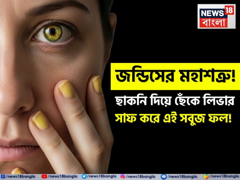 গ্রীষ্ম এবং বর্ষাকালে শরীরের অনেক সমস্যা বেড়ে যায়। এর মধ্যে একটি হল জন্ডিস, যা প্রায়শই শিশুদের পাশাপাশি বয়স্কদেরও প্রভাবিত করে। এই রোগ দুর্বলতা এবং কর্মক্ষমতা হ্রাসের পাশাপাশি লিভারের মারাত্মক ক্ষতি করতে পারে। কখনও কখনও এটি এতটাই গুরুতর হয়ে ওঠে যে এটি জীবনের জন্য হুমকিস্বরূপও হয়ে ওঠে।