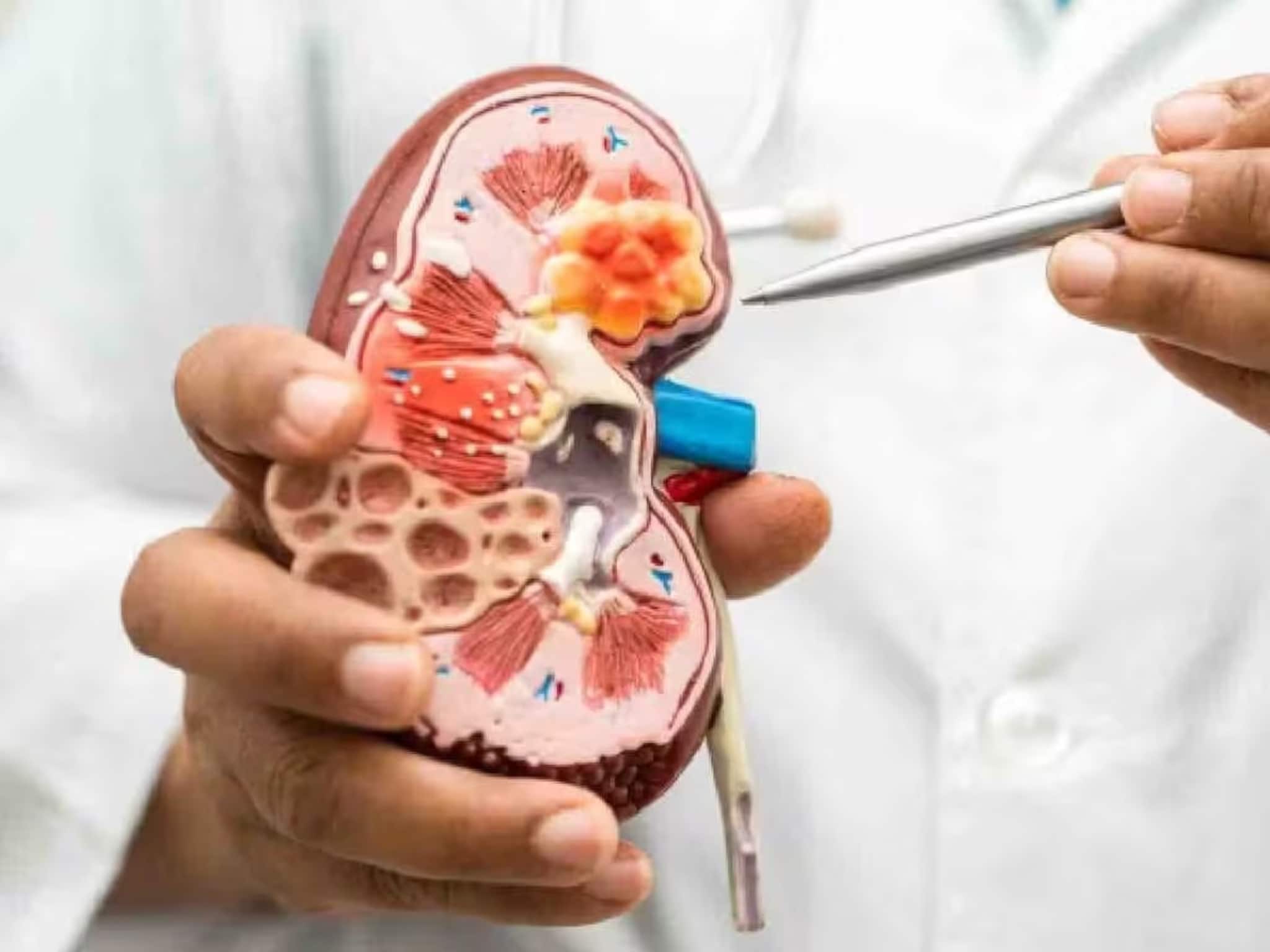 Kidney Damage Symptoms: মুখে দুর্গন্ধ বা অনিদ্রাও 'কিডনি' বিকল হওয়ার লক্ষণ হতে পারে, আর কোন ৭ উপসর্গ জানান দেয় আপনার কিডনি নষ্ট হচ্ছে? পড়ুন