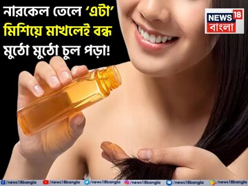 দলা দলা চুল পড়ে মাথায় টাক? নারকেল তেলে ‘এটা’ মিশিয়ে মাখলেই বন্ধ মুঠো মুঠো চুল পড়া!