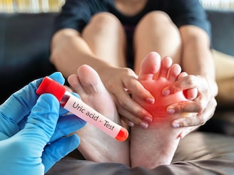 হাই ইউরিক অ্যাসিডে কাজে আসতে পারে সহজ ঘরোয়া কৌশল, দেখে নিন এক নজরে