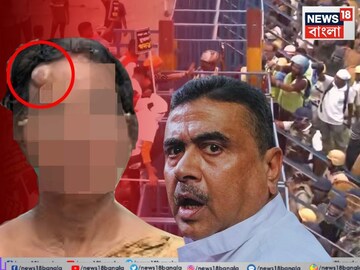 মিছিলে গিয়ে পুলিশের মারের অভিযোগ, হাসপাতালে ভর্তি আরজি করের নির্যাতিতার মা! দেখতে গেলেন শুভেন্দু