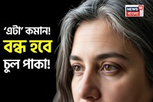 অল্প বয়সেই মাথা ভর্তি সাদা চুল? ‘এটা’ কমান! বন্ধ হবে চুল পাকা! সাদা হবে না বাকি কালো চুল