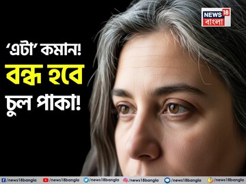 অল্প বয়সেই মাথা ভর্তি সাদা চুল? ‘এটা’ কমান! বন্ধ হবে চুল পাকা! সাদা হবে না বাকি কালো চুল