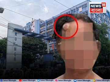 News18