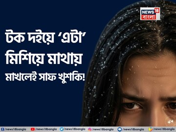 টক দইয়ের সঙ্গে ‘এটা’ মিশিয়ে মাথায় মাখলেই সাফ খুশকি! বর্ষায় ঝরবে না গুচ্ছ গুচ্ছ চুল!