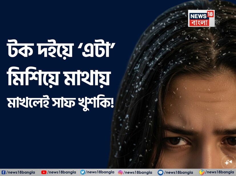 বর্ষাকাল শীতলতা এবং স্বস্তি এনে দিলেও, খুশকির সমস্যাও বাড়ায়। আর্দ্রতা বৃদ্ধি এবং ঘামের কারণে মাথার ত্বকে ছত্রাকের সংক্রমণ দেখা দেয়। এই খবরে, কিছু সহজ ঘরোয়া প্রতিকারের মাধ্যমে বর্ষাকালে খুশকি কীভাবে এড়ানো যায় তা জেনে নিন। বর্ষাকালে বাতাসে আর্দ্রতা বেড়ে যায়, যার ফলে মাথার ত্বকে ঘাম এবং ময়লা জমতে শুরু করে। এর ফলে ছত্রাকের সংক্রমণের ঝুঁকি বেড়ে যায় এবং খুশকির সমস্যা শুরু হয়। সময়মতো যত্ন না নিলে চুল পড়ারও কারণ হতে পারে।
