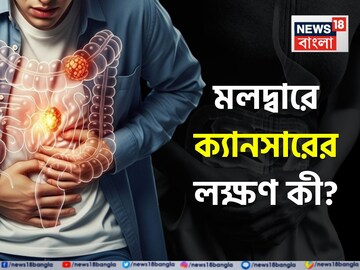 মলদ্বারে ক্যানসারের লক্ষণ কী? 'এটা’ বেশি খাওয়ার জন্য ছড়াচ্ছে কোলন ক্যানসার! জানুন