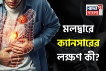 মলদ্বারে ক্যানসারের লক্ষণ কী? 'এটা’ বেশি খাওয়ার জন্য ছড়াচ্ছে কোলন ক্যানসার! জানুন