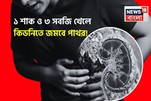 ১ শাক ও ৩ সবজি খেলে নিজেই নিজের কবর খুঁড়বেন! কিডনিতে জমবে পাথর! আজই বিদেয় করুন ডায়েট থেকে