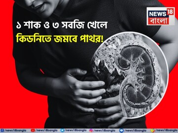 ১ শাক ও ৩ সবজি খেলে নিজেই নিজের কবর খুঁড়বেন! কিডনিতে জমবে পাথর! আজই বিদেয় করুন ডায়েট থেকে