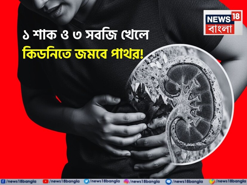 ভারতে কিডনিতে পাথরের ঘটনা বৃদ্ধি পাচ্ছে। এই কারণেই কিডনিতে পাথর আক্রান্তদের তালিকা দীর্ঘ। এর ব্যথা যে কাউকে দুর্দশাগ্রস্ত করার জন্য যথেষ্ট। এর সবচেয়ে বড় কারণ হল অস্বাস্থ্যকর খাদ্যাভ্যাস, খারাপ জীবনধারা এবং ব্যায়ামের অভাব। 