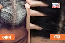 কলপ, ডাই, রং ছাড়ুন...! এই 'জিনিস' দিয়েই কুচকুচে কালো হবে 'সাদা' চুল, ৩০ দিনেই তফাৎ