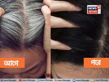 কলপ, ডাই, রং ছাড়ুন...! এই 'জিনিস' দিয়েই কুচকুচে কালো হবে 'সাদা' চুল, ৩০ দিনেই তফাৎ