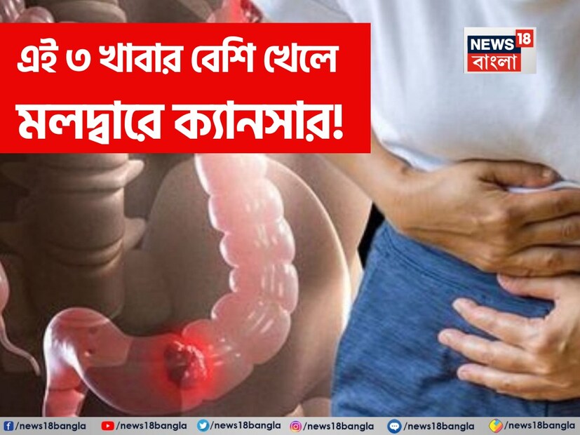 মলদ্বারে ক্যানসার হয় এই ৩ খাবার বেশি খেলে! এই মারণ রোগ থেকে বাঁচাবে কোন খাবার? জানুন