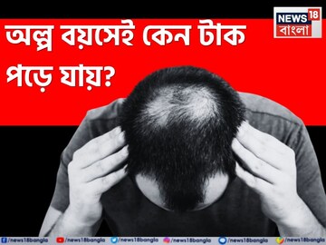 তোয়ালে দিয়ে 'এটা' করলেই অল্প বয়সে টাক পড়বে মাথায়! তেল মালিশ করলে কমবে চুল পড়া? জানুন