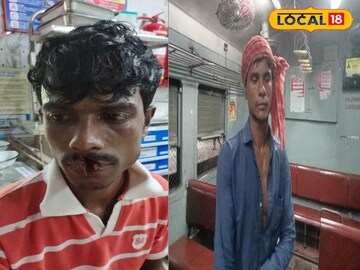 আহত রেলযাত্রী