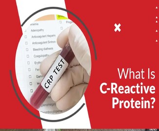 শরীরে CRP মাত্রা বেশি? সি-রিঅ্যাকশন প্রোটিন মানে কী? কখন এটি বাড়ে? বাড়লে কী কী ক্ষতি?