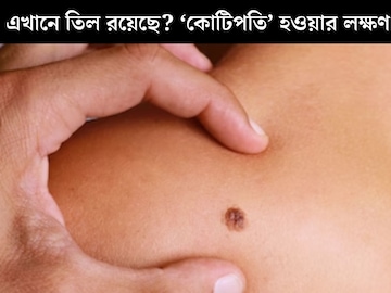 ‘কোটিপতি’ হওয়ার লক্ষণ! মেয়েদের শরীরে কোন অঙ্গে তিল থাকলে টাকার অভাব হয় না? ‘কোটিপতি’ হওয়ার লক্ষণ! মেয়েদের শরীরে কোন অঙ্গে তিল থাকলে টাকার অভাব হয় না?