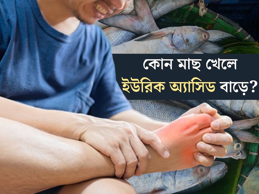 বাঙালির মাছ প্রেম সর্বজনবিদিত। চিরাচরিত মাছের ঝোল, ঝাল, কালিয়া, ভাজা, টক থেকে হালের ফিশ ফ্রাই, মাছ খাওয়ার রেসিপি হাজার। মাছে থাকে প্রচুর প্রোটিন। কিন্তু মাছ খাওয়ারও কী রয়েছে কোনও পার্শ্বপ্রতিক্রিয়া।