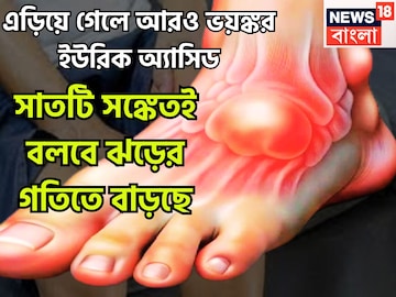 এড়িয়ে গেলে আরও ভয়ঙ্কর ইউরিক অ্যাসিড, শরীর জুড়ে ব্যথায় ফালাফালা! সাতটি সঙ্কেতই বলবে