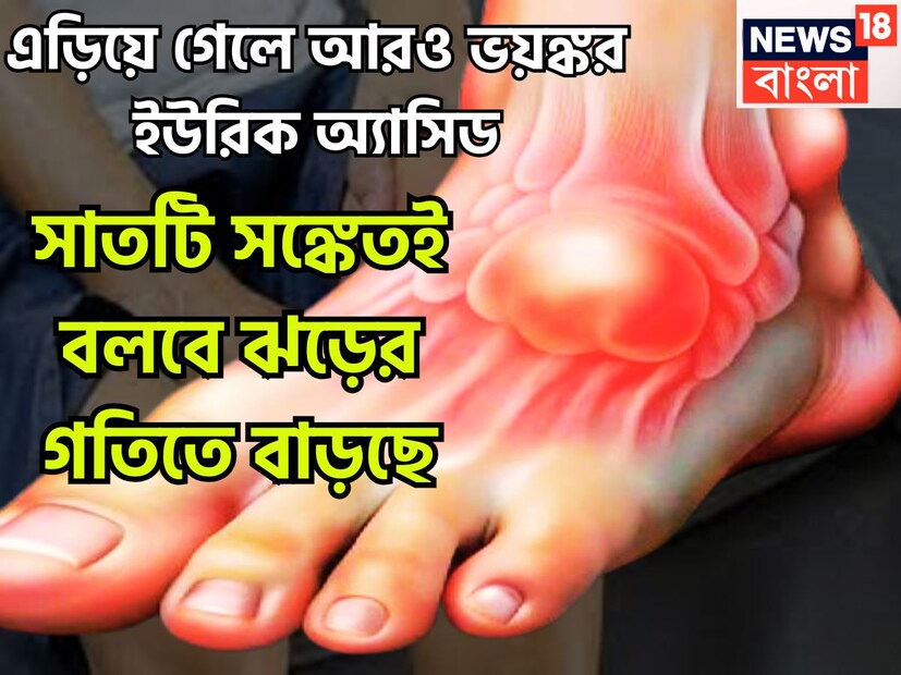 শরীরে ইউরিক অ্যাসিড বৃদ্ধিপ্রাপ্ত হলেই কয়েকটি লক্ষণ দেখতে পাওয়া যায়, সাতটি ভয়ঙ্কর সঙ্কেত লক্ষ্য করে এড়িয়ে গেলে চলবেনা ৷ প্রতীকী ছবি ৷